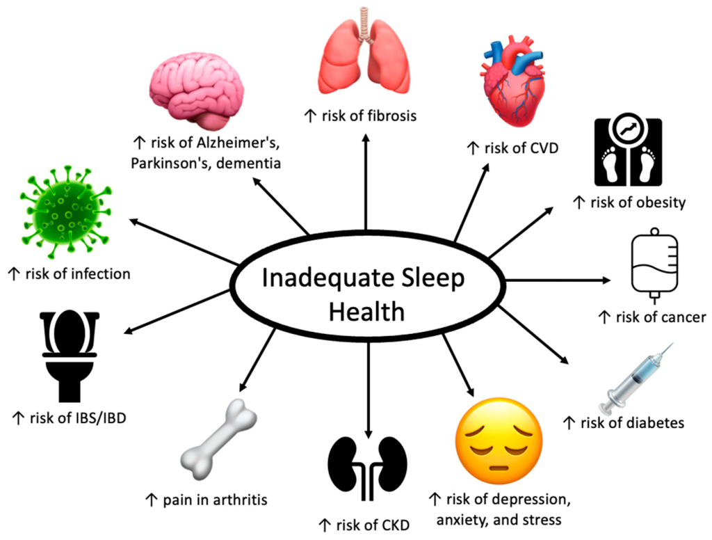Of Sleep